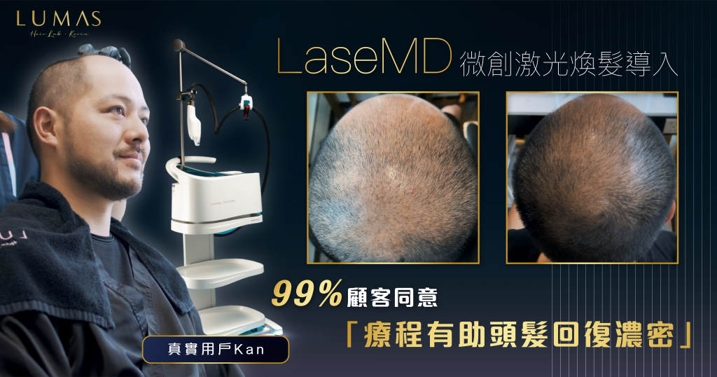 LaseMD 活髮療程 用戶體驗